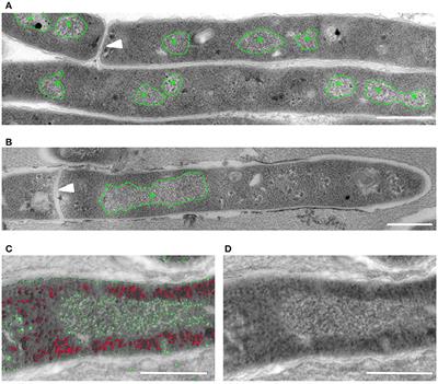 Interfering With DNA Decondensation as a Strategy Against Mycobacteria